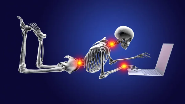 Working with laptop in a wrong position. Concept of backache, back pain. 3D illustration showing a human skeleton working in a wrong position