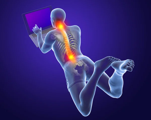 Working with laptop in a wrong position. Concept of backache, back pain. 3D illustration showing male body with highlighted skeleton working in a wrong position