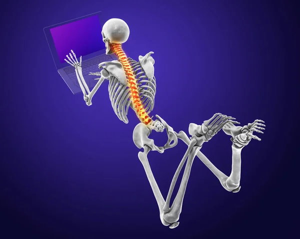 Working with laptop in a wrong position. Concept of backache, back pain. 3D illustration showing a human skeleton working in a wrong position
