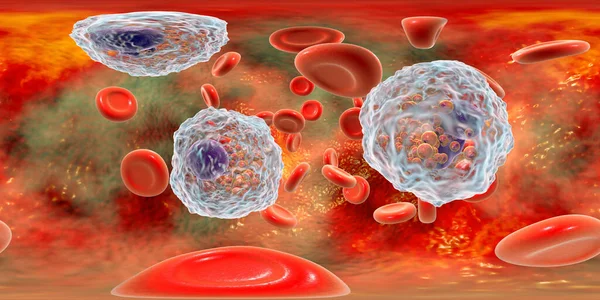 360 Degree Spherical Panorama Blood Eosinophilia Showing Multiple Eosinophils Surrounded — Stock Photo, Image