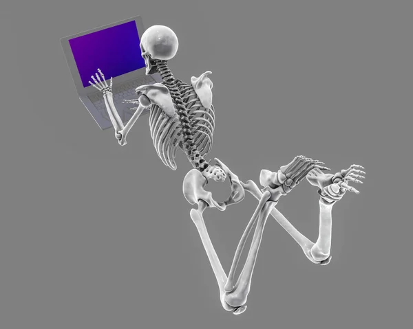 ラップトップを間違った位置で使用しています 腰痛の概念 間違った位置で働いている人間の骨格を示す3Dイラスト — ストック写真