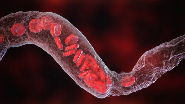 Vasoconstrictie Vorming Van Stolsels Bloedvaten Erytrocyten Die Door Vernauwing Van — Stockfoto