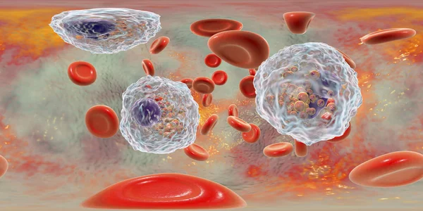 赤血球に囲まれた複数の好酸球を示す好酸球症と血液の360度球面パノラマ 3Dイラスト — ストック写真