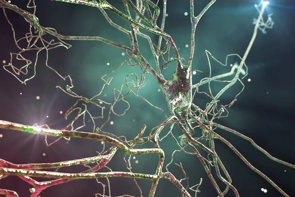 Нейроны Мозга Клетки Мозга Человека Иллюстрация Человеческая Нервная Система — стоковое фото