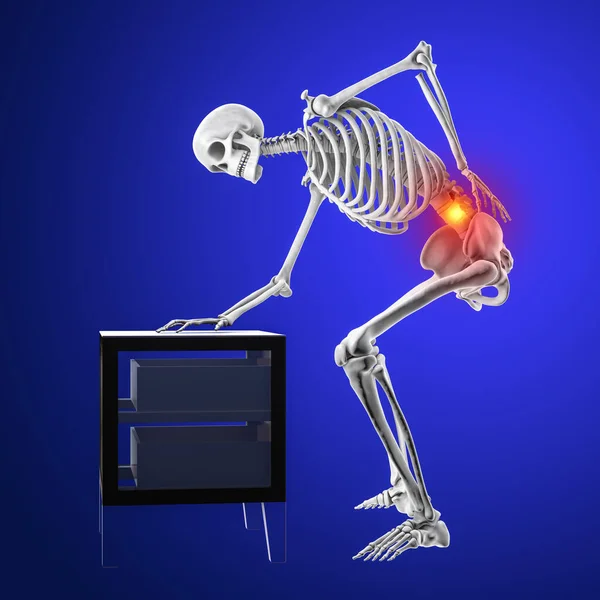 人类脊椎疼痛 概念三维图解显示人类骨骼与痛苦的背痛 — 图库照片