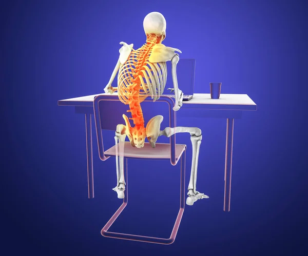 Working with laptop in a wrong position. Concept of backache, back pain. 3D illustration showing human skeleton working in a wrong position