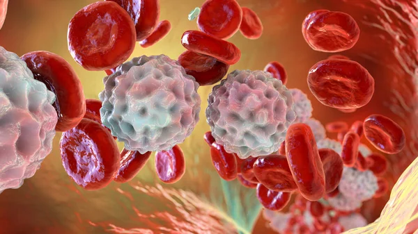 Lymphocytosis Leukocytosis Illustration Showing Abundant White Blood Cells Blood Vessel — Stock Photo, Image