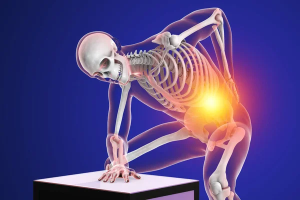 人間の背骨の痛み 概念的な3Dイラスト — ストック写真