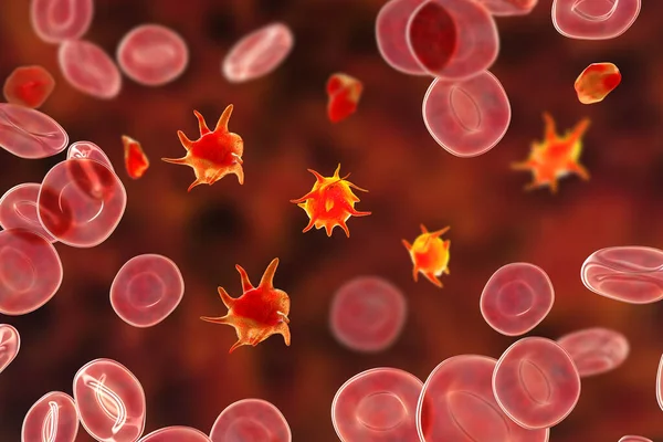 Тромбоцити Мазку Крові Ілюстрація Активовані Неактивовані Тромбоцити Еретроцити — стокове фото