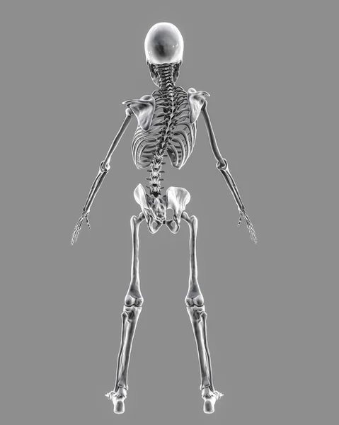 大腸炎 3Dイラスト 湾曲した背骨と不均一な肩と腰を持つ人間の骨格 — ストック写真