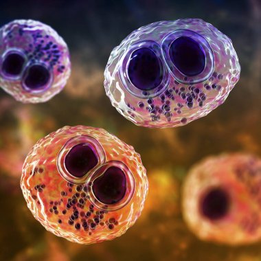 Cytomegalovirus CMV in a human cell, owl's eye inclusion in nucleus, multinucleated cell, 3D illustration. It is herpes virus, causes diseases in fetus, organ transplant patients, HIV infected people clipart