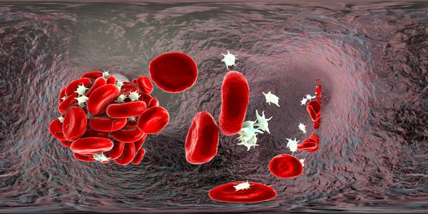 Coágulo Sangre Hecho Glóbulos Rojos Plaquetas Hebras Proteína Fibrina Vista — Foto de Stock