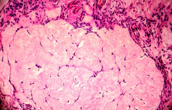 卵巣嚢胞 軽いマイクログラフ 顕微鏡下での写真 写真は雌の卵巣の嚢胞の断片を示しています 選択的焦点 — ストック写真