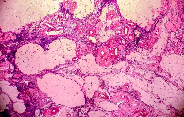 卵巣嚢胞 軽いマイクログラフ 顕微鏡下での写真 写真は雌の卵巣の嚢胞の断片を示しています 選択的焦点 — ストック写真