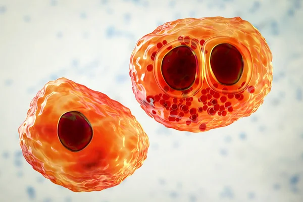 Цитомегаловирус Вызвал Изменения Человеческой Клетке Известной Клетка Глаза Совы Мультинуклированные — стоковое фото