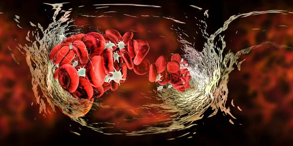 Krevní Sraženina Červených Krvinek Krevních Destiček Fibrinových Proteinových Vláken 360 — Stock fotografie