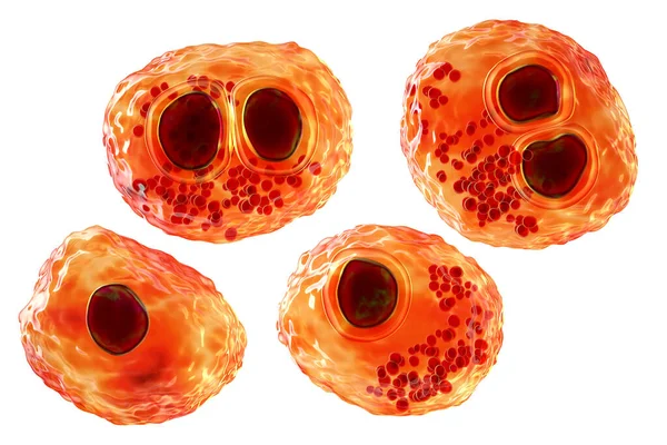 ヒト細胞における細胞小器官ウイルスCmv 核におけるフクロウの眼の包含 多核細胞 3Dイラスト それはヘルペスウイルスであり 胎児の病気を引き起こし 臓器移植患者 Hiv感染者 — ストック写真