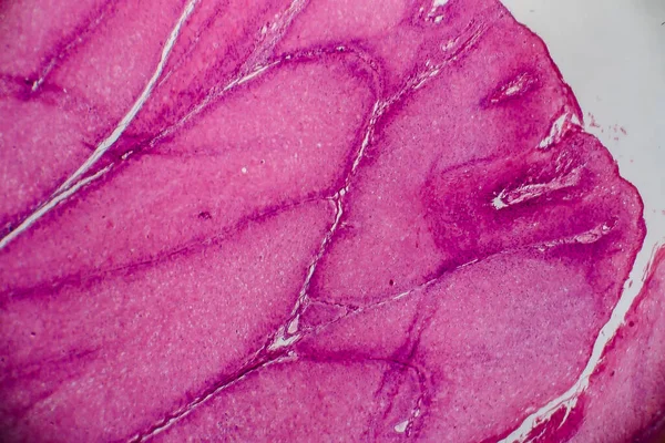 Condyloma Acuminatum Auch Bekannt Als Genitalwarzen Lichtmikroskopie Foto Unter Dem — Stockfoto