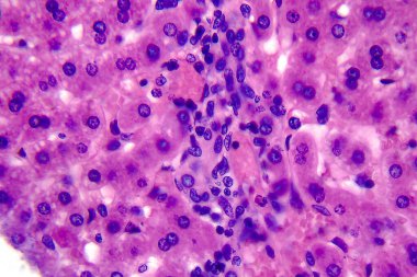 Coccidiosis, coccidia in liver, light micrograph, photo under mikroskop