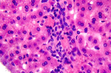 Coccidiosis, coccidia in liver, light micrograph, photo under microscope clipart