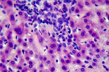 Coccidiosis, coccidia in liver, light micrograph, photo under mikroskop