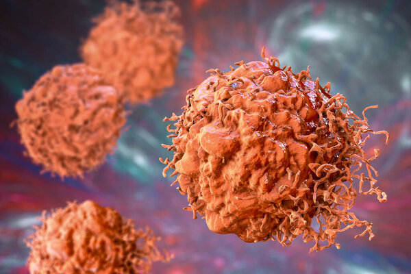 Cancer cells, malignant cells, scientific 3D illustration