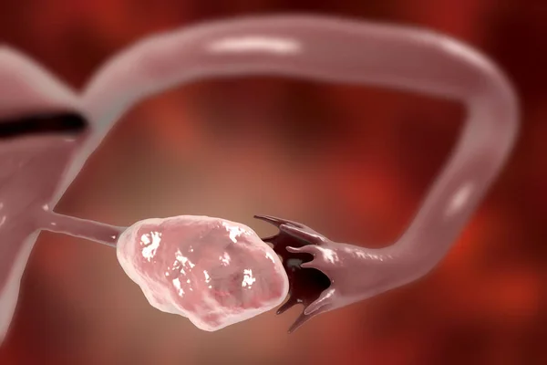 Tabung Ovarium Dan Falopi Yang Sehat Ilustrasi — Stok Foto