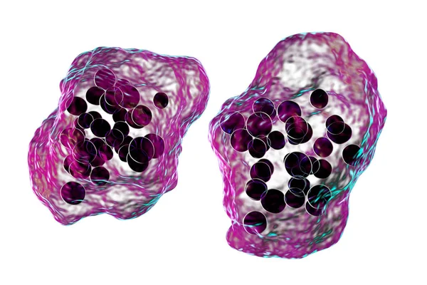 Enfermedad Del Sarampión Células Gigantes Multinucleadas Vistas Durante Microscopía Especímenes — Foto de Stock