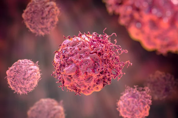 Células Cancerígenas Células Malignas Ilustração Científica — Fotografia de Stock