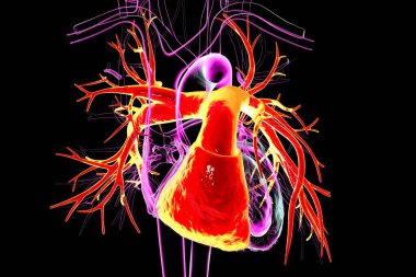 Sağ karıncığı ve pulmoner gövdesi kırmızı üç boyutlu resimle işaretlenmiş insan kalbi. Ciğerlere deoksijensiz kan yolu gösteriyor..