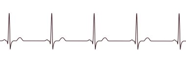 Normal ECG, 3D illüstrasyon normal P dalgaları, QRS kompleksleri ve kararlı RR aralıklarla standart sinüs ritmi gösteriyor.