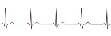 Normal ECG, 3D illüstrasyon normal P dalgaları, QRS kompleksleri ve kararlı RR aralıklarla standart sinüs ritmi gösteriyor.