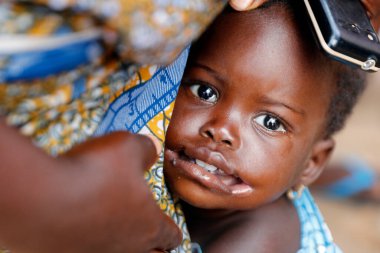 Afrika hastanesi. Pediyatri ünitesi. Tıbbi danışmanlık. Benin.. 