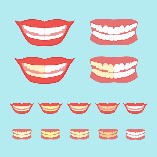 Whitening dentes vetor ilustração isolado no fundo azul —  Vetores de Stock