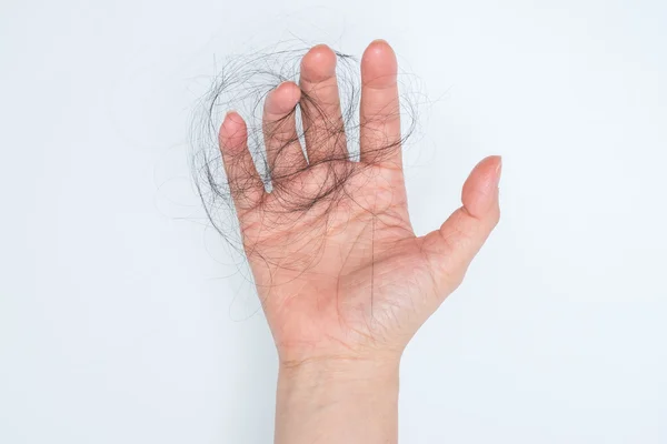 Hair loss problem — Stock Photo, Image