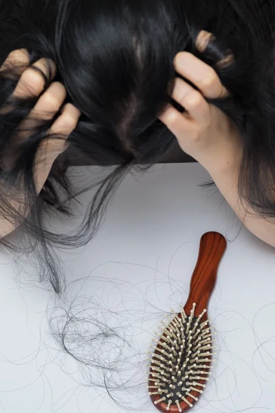 Mulher problema de perda de cabelo — Fotografia de Stock