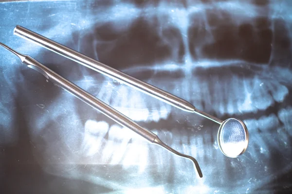 Рентгенівська зйомка рота людини і зубів — стокове фото