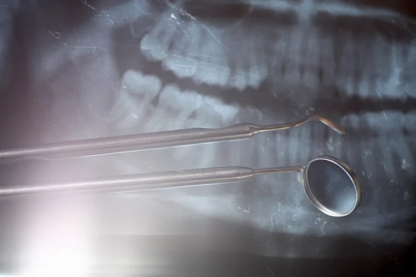 Рентгеновское и стоматологическое зеркало — стоковое фото