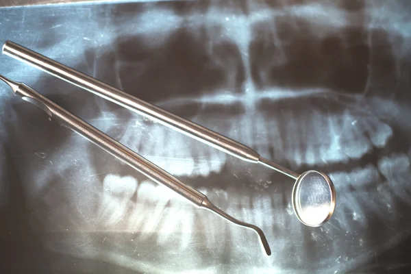 Рентгенівське та стоматологічне дзеркало — стокове фото