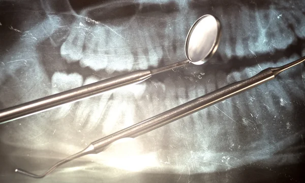 Рентгенівське та стоматологічне дзеркало — стокове фото