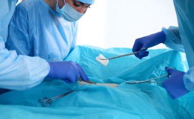 işlemi gerçekleştirmek için yetenekli cerrahları oluşan bir ekip