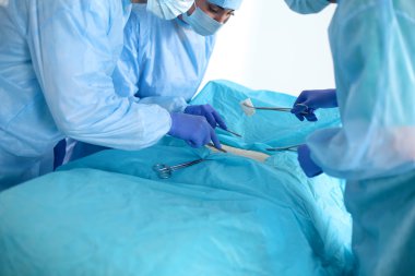 takım cerrah üniformalı bir hastanın kalp cerrahisi kliniğinde işlemi gerçekleştirmek