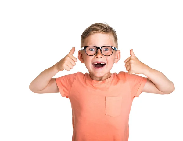 Портрет счастливого мальчика, показывающего большие пальцы на белом фоне. Возвращайся в школу. Блондинка в очках с открытым ртом. Веснушчатое лицо с молоком или выпавшим временным зубом — стоковое фото