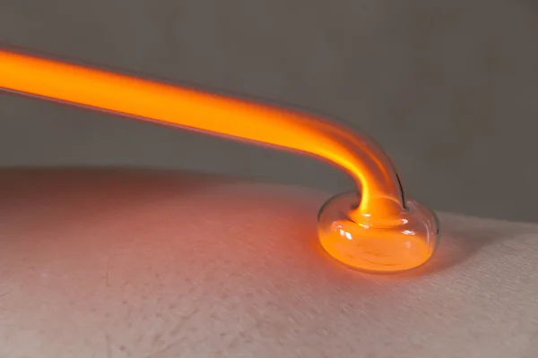 Tıbbi prosedür darsonvalization