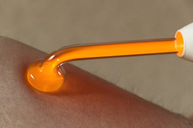 Tıbbi prosedür darsonvalization