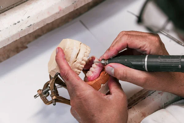 Руки зубного техника, подающего зубной имплантат — стоковое фото