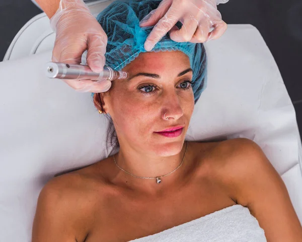 Professionele cosmetoloog uitvoeren van procedure van mesotherapie met dermapen micro naalden aan volwassen vrouw — Stockfoto