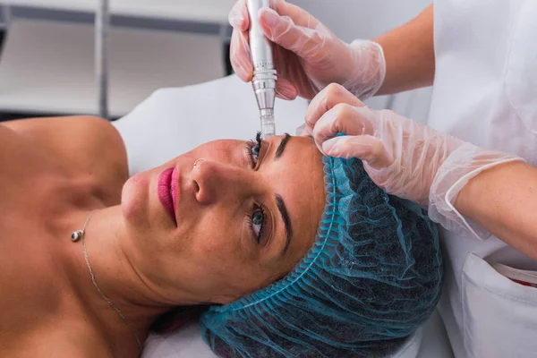 Side view van een vrouw die mesotherapie behandeling met dermapen op het gezicht door anonieme cosmetoloog — Stockfoto