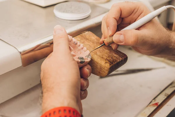 Visão de perto das mãos de um profissional usando uma ponta de um afiador para aplicar cera em um molde dental em um laboratório — Fotografia de Stock