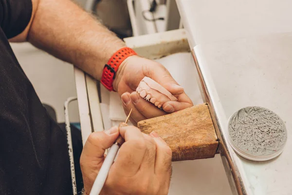 Foto aerea con vista ravvicinata delle mani di un uomo che modella con cera uno stampo dentale in laboratorio — Foto Stock